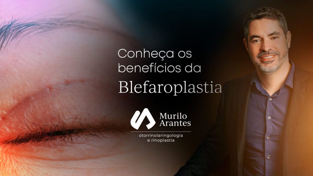 Beneficios da Blefaroplastia