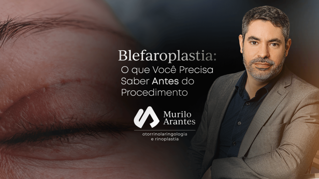 blefaroplastia