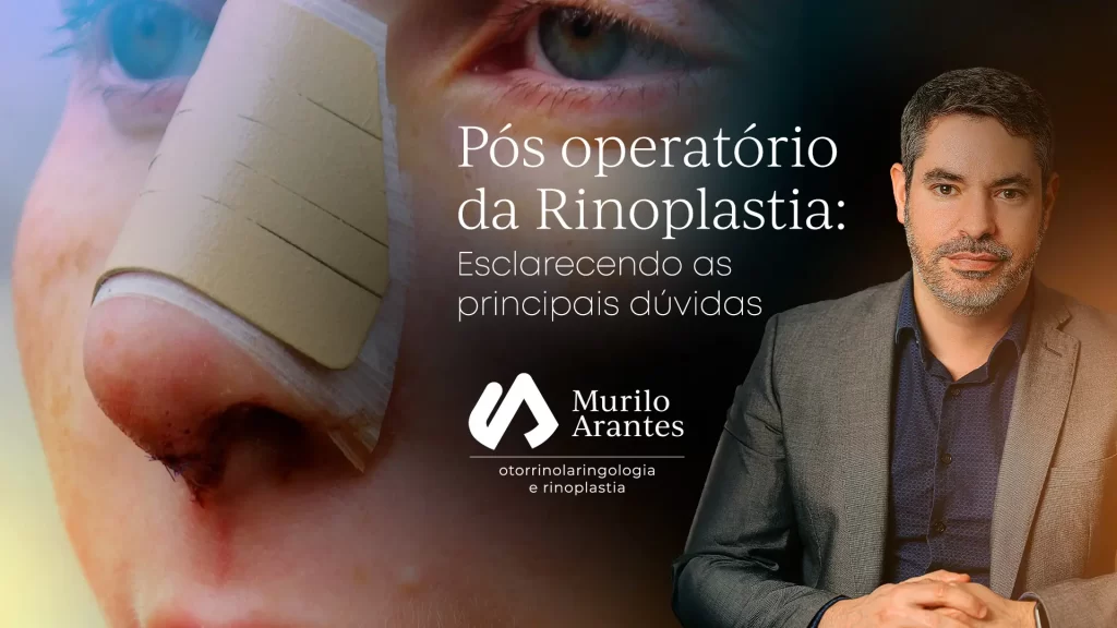 RINOPLASTIA E DOR COMO FUNCIONA O PÓS-OPERATÓRIO