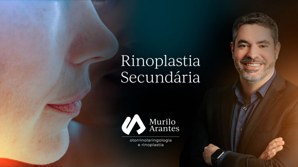 especialista em rinoplastia secundaria