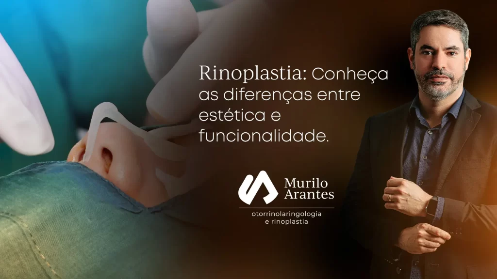 Rinoplastia Conheça as diferenças entre estética e funcionalidade